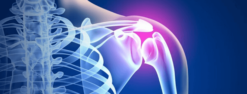 Come la chirurgia mini-invasiva può contribuire a risolvere i problemi articolari della spalla